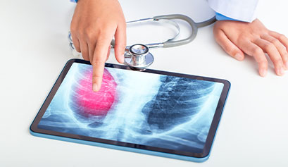 Na zdjęciu widoczny jest tablet, na którym widoczne jest zdjęcie rentgenowskie płuc, z wyraźnie zaznaczonym czerwonym fragmentem. Wskazuje na nie palcem lekarz. Fotografia pochodzi z adobe stock.